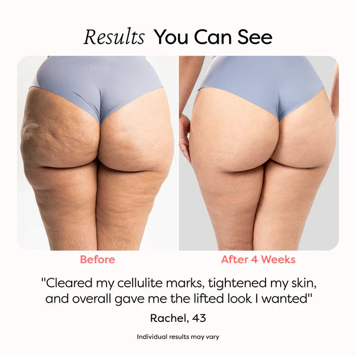 RolliTone™ | Say Goodbye to Cellulite, One Roll at a Time!