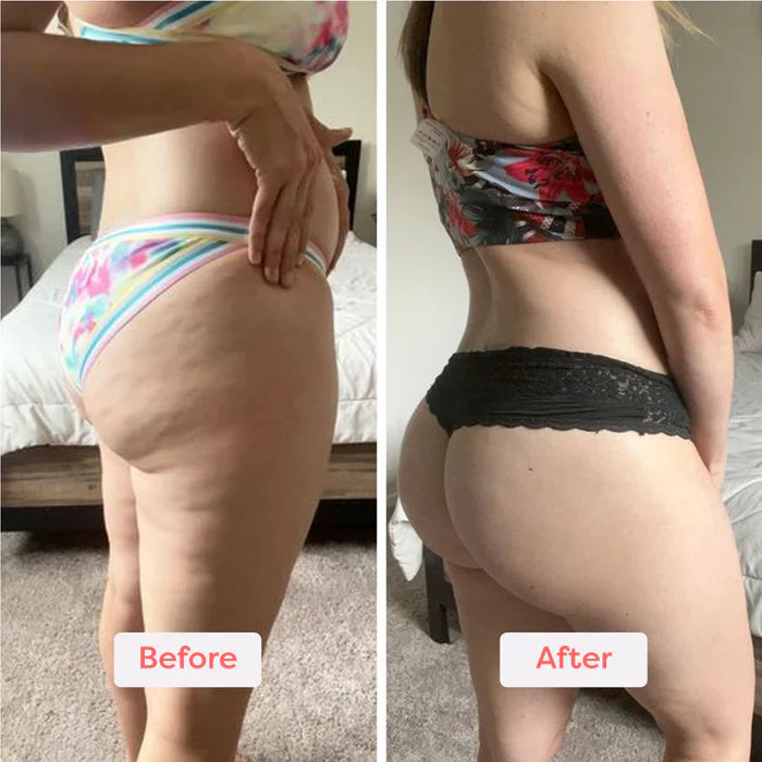 RolliTone™ | Say Goodbye to Cellulite, One Roll at a Time!