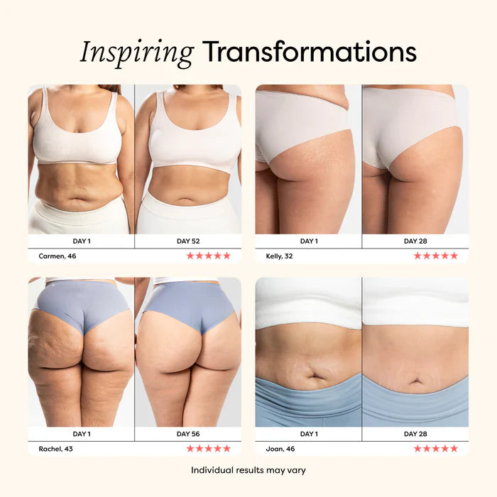 RolliTone™ | Say Goodbye to Cellulite, One Roll at a Time!