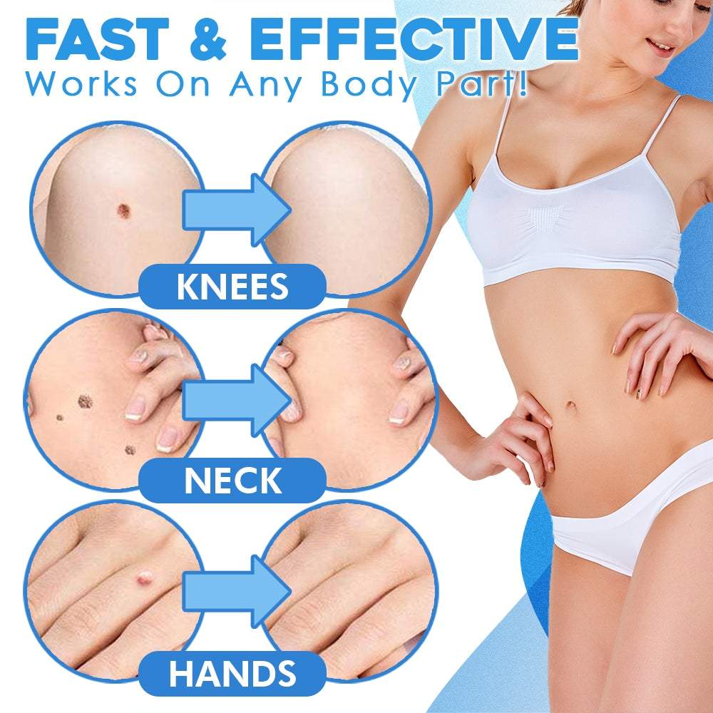 TagOff™ | Advanced Skin Tag Removal Kit