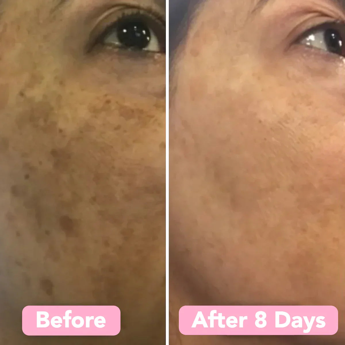Velleara™ | Natural Brightening Pads For Clear Radian Skin