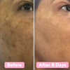 Velleara™ | Natural Brightening Pads For Clear Radian Skin