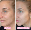 Velleara™ | Natural Brightening Pads For Clear Radian Skin