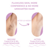 LumaGlow™ | The Ultimate At-Home Laser Hair Removal Solution
