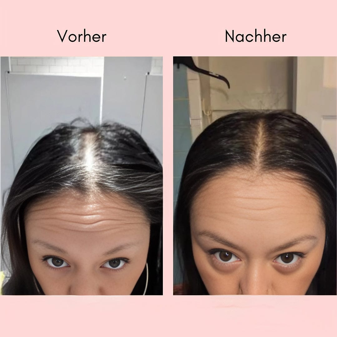 Rootéva™ | Nature’s Answer to Thinning Hair!