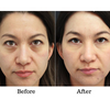 EyeVerra™ | Firm the Look, Brighten the Eyes!