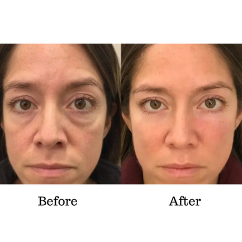 EyeVerra™ | Firm the Look, Brighten the Eyes!