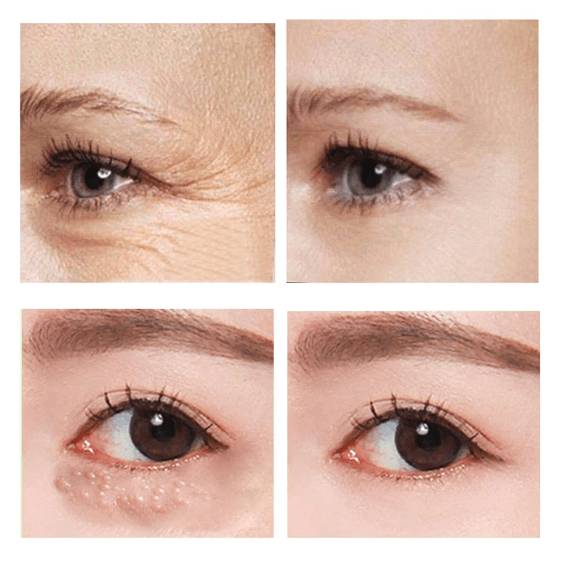 EyeVerra™ | Firm the Look, Brighten the Eyes!