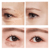 EyeVerra™ | Firm the Look, Brighten the Eyes!