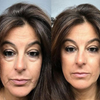 EyeVerra™ | Firm the Look, Brighten the Eyes!