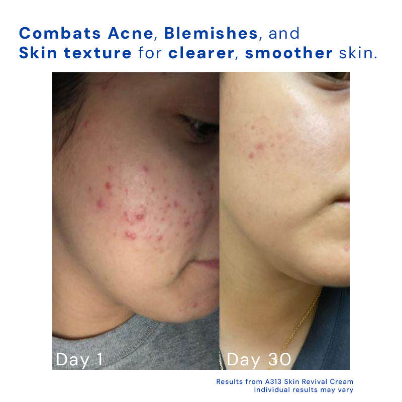 AgeAway™ | Daily Radiance for a Younger-Looking Face