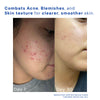 AgeAway™ | Daily Radiance for a Younger-Looking Face