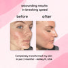 Velleara™ | Natural Brightening Pads For Clear Radian Skin