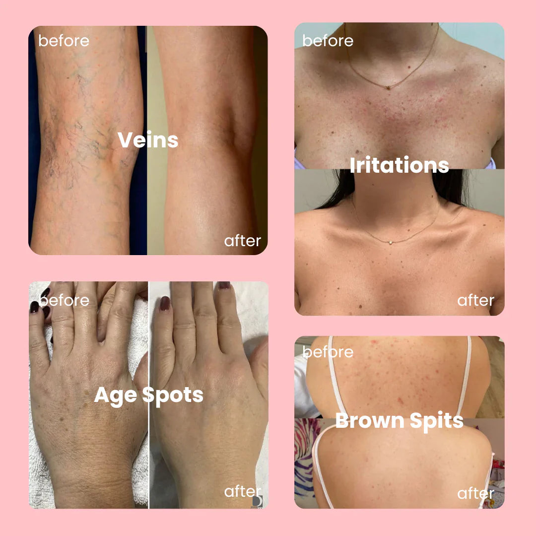 BodyBlur™ | Seamless Body Coverage That Won’t Budge