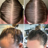 GrowEssence™ | The Most Effective Remedy For Fast Hair Growth