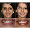 Radiance Elixir™ | Make your smile shine effortlessly