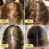 Carvenhy™ | The Ultimate Solution for Hair Regrowth