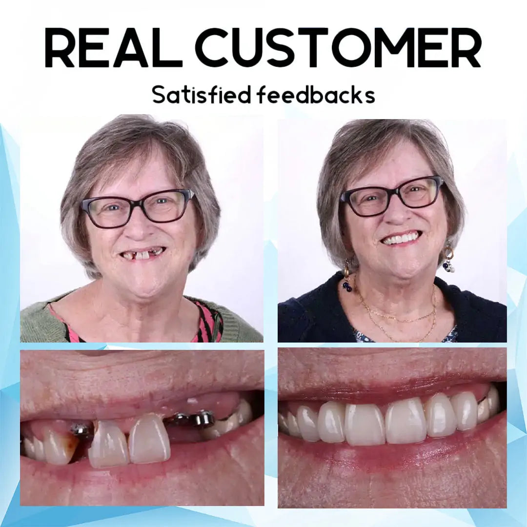 FlexiFit™ | Premium Fit Silicone Dentures