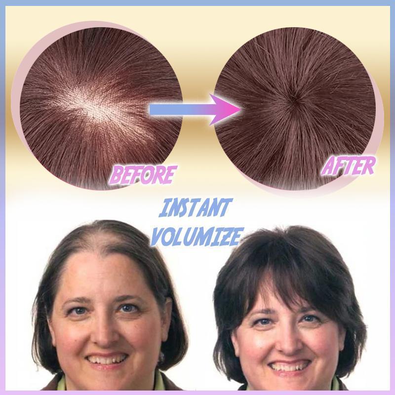 HairLift™ | Hide Thinning Hair Effortlessly!