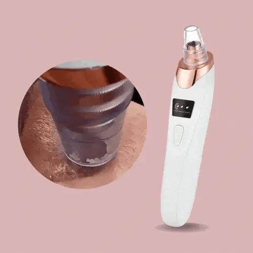 SkinSuction™ | Your Skin’s Best Friend Against Blackheads
