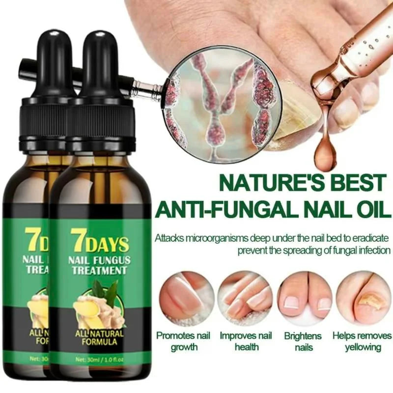 FungaRelief™ | Natural Fungus Removal in 7 Days!
