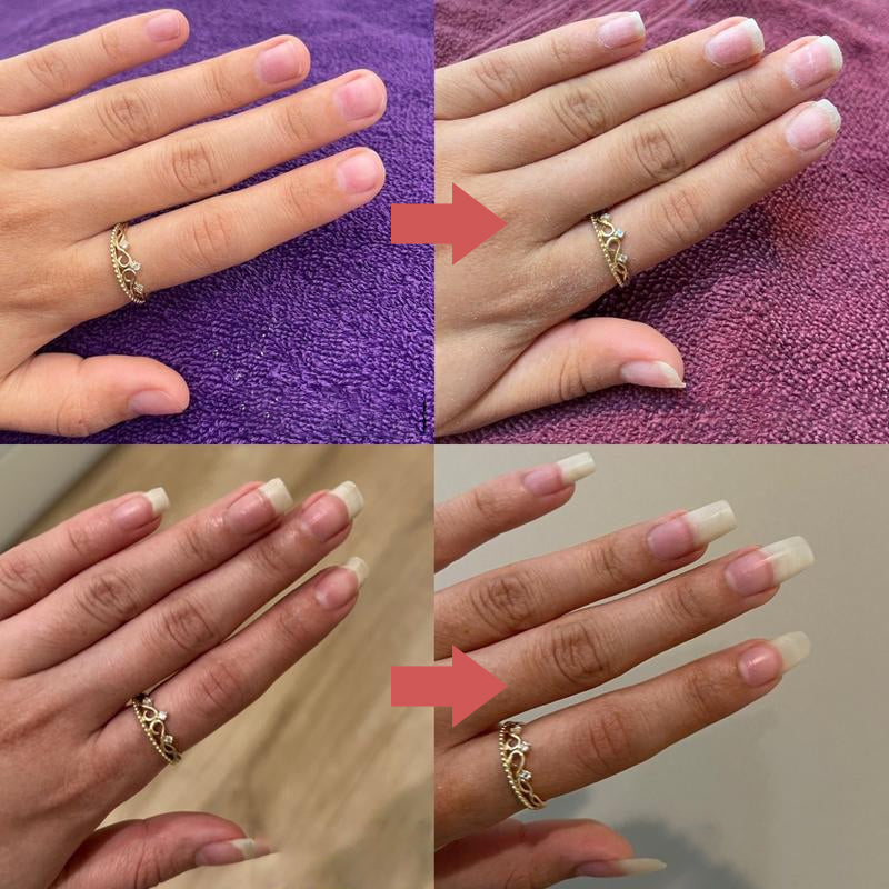 NailNourish™ | Shinier, Stronger, Healthier Nails — Naturally!