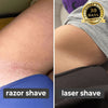 SilkShaver Hair Eraser | (FINAL DAY OF SALE!)