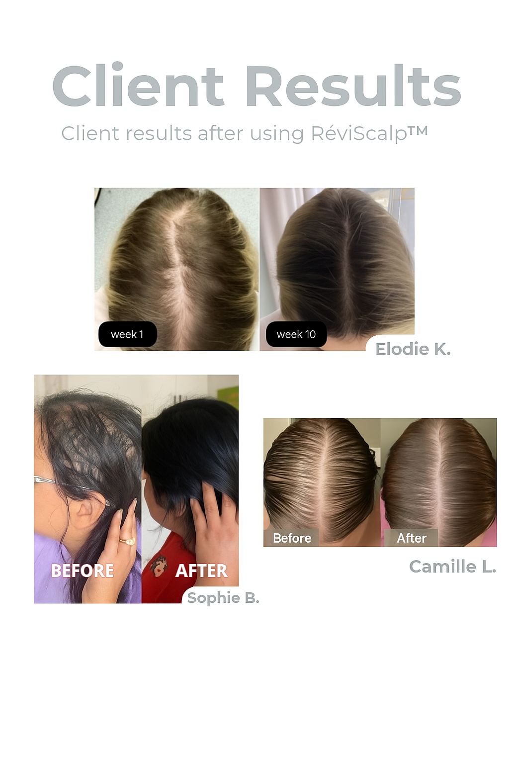 HairVive™ | Reverse Balding in 10 Minutes a Day — No Side Effects!
