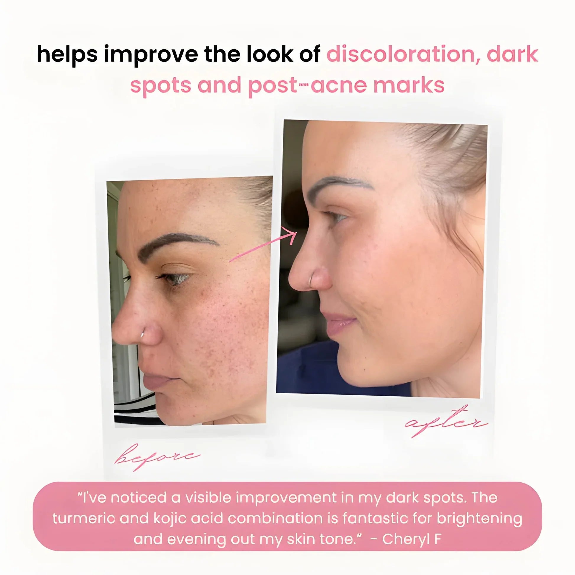 SpotLessGlow™ | For Smoother, Clearer, and Brighter Skin — Every Day!