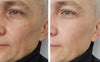 YouthRevive™ | Age-Defying Wrinkle Cream Balm