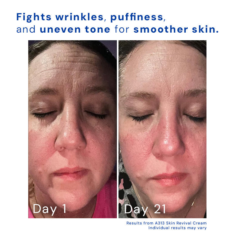 AgeAway™ | Daily Radiance for a Younger-Looking Face