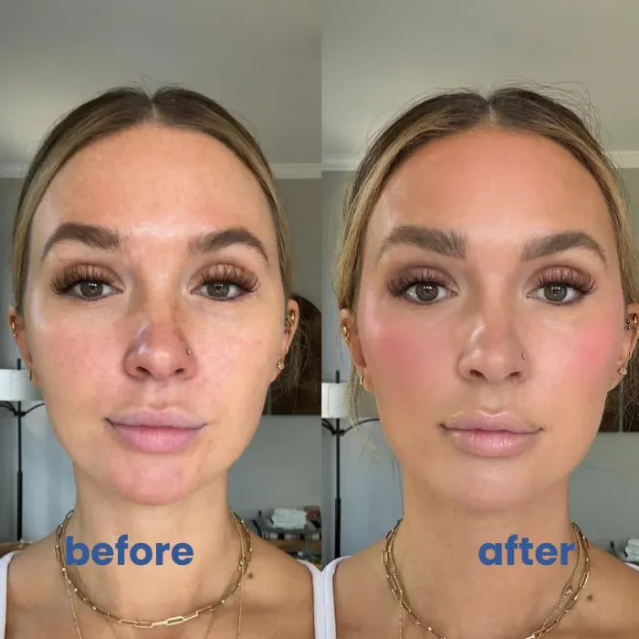 SkinTune™ | For Skin That Looks As Even As It Feels