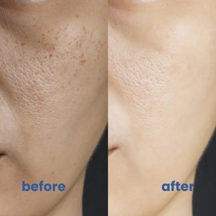 SkinTune™ | For Skin That Looks As Even As It Feels