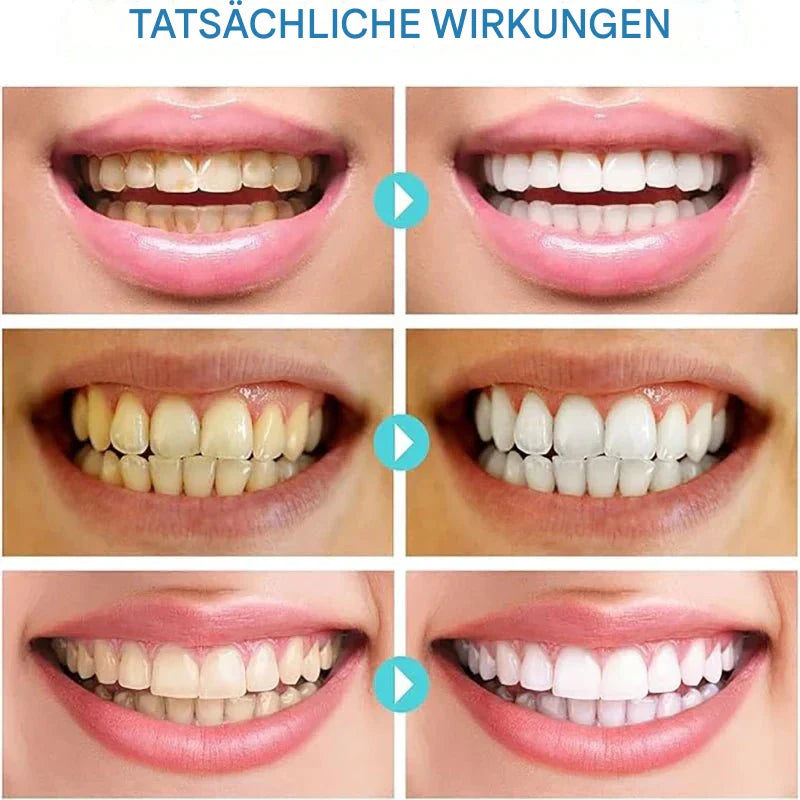 SmileBoost™ | Science-Backed Care for Healthy Teeth