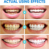 ClearSmile™ | Whiter Teeth, Healthier Gums, Cleaner Mouth.