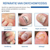 NailRenew™ | Protect And Restore Your Nails From Fungus