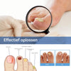 NailRenew™ | Protect And Restore Your Nails From Fungus