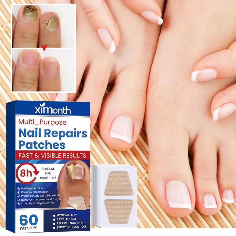 NailRenew™ | Protect And Restore Your Nails From Fungus