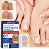 NailRenew™ | Protect And Restore Your Nails From Fungus